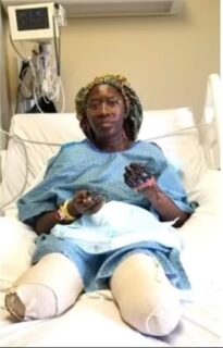 【アメリカ】医療従事者の女性、ファイザー製コロナワクチンを２回接種後、両手両足が壊死して切断