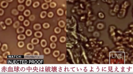 【画像・動画あり】医師らの研究により、コロナワクチンが体内の赤血球を破壊する猛毒であることが発覚!!