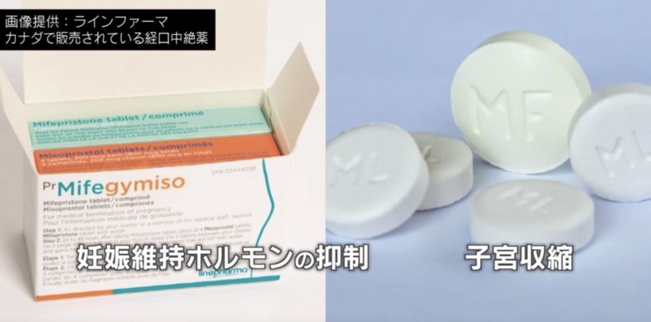 【医療の闇】海外で数百円程度で購入できる「経口中絶薬」を日本産婦人科医会が10万円で販売すると主張