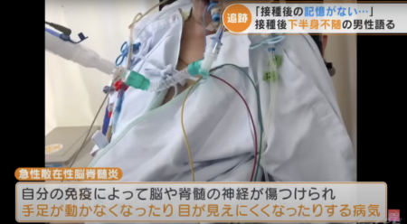 【名古屋】コロナワクチン接種した40代男性、40度近い高熱が出て、髄膜炎・肺炎を発症し記憶を失う　下半身不随で排泄も困難な状況が続く