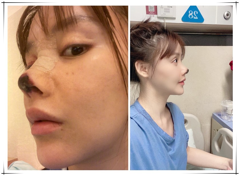 日本国内で無資格で美容整形を行う中国人・ベトナム人が急増　中国の美容医療クリニックは86%が無資格でトラブル多発