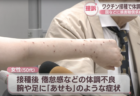 【薬害】岡山県に住む50代女性、コロナワクチン接種後に体調不良になったとして国や製薬会社に約1320万円の損害賠償を求める　皮膚からワクチン由来の『スパイクタンパク質』が長期で検出