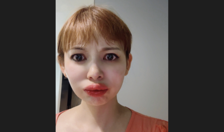 【中川翔子】唇が大きく膨れ上がった写真を公開　突然のアレルギー症状に悩まされていることを告白　コロナワクチンを3回接種